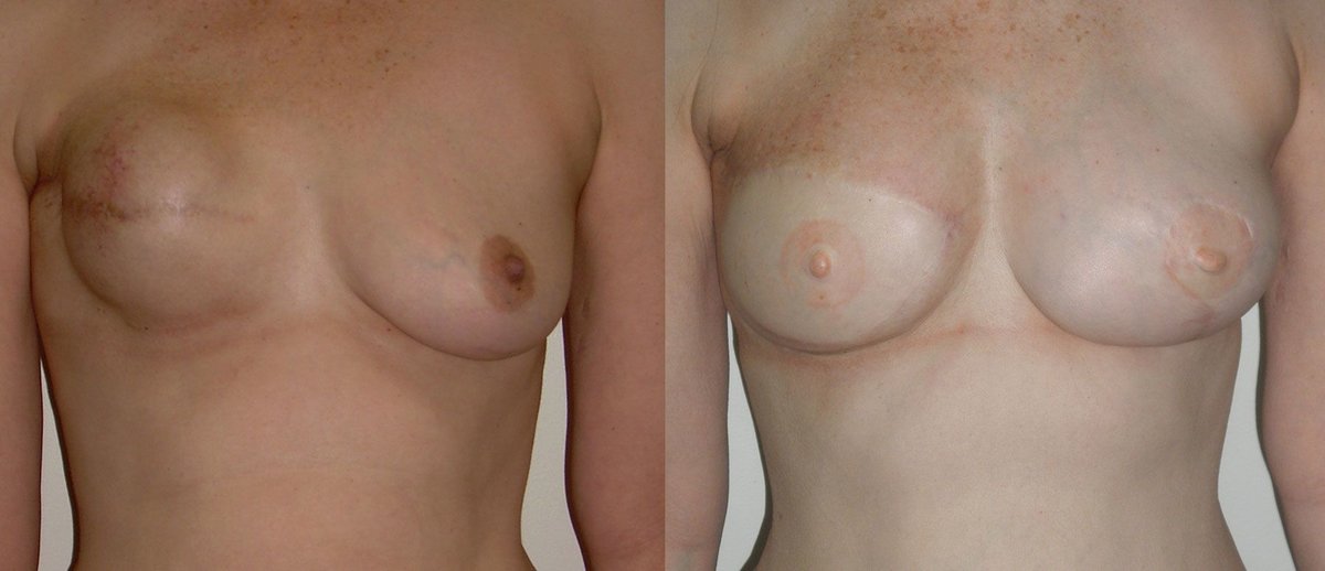 Clínica Láser Puebla - Clínica Láser Puebla