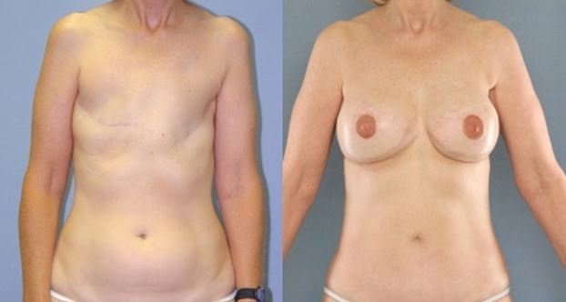 Clínica Láser Puebla - Clínica Láser Puebla