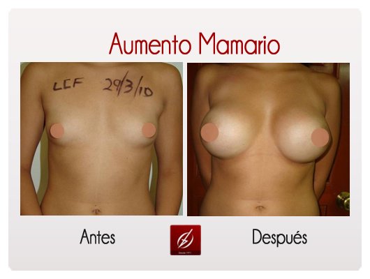 Clínica Láser Puebla - Clínica Láser Puebla