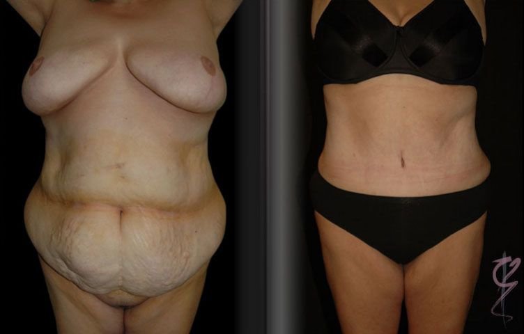 Clínica Láser Puebla - Clínica Láser Puebla