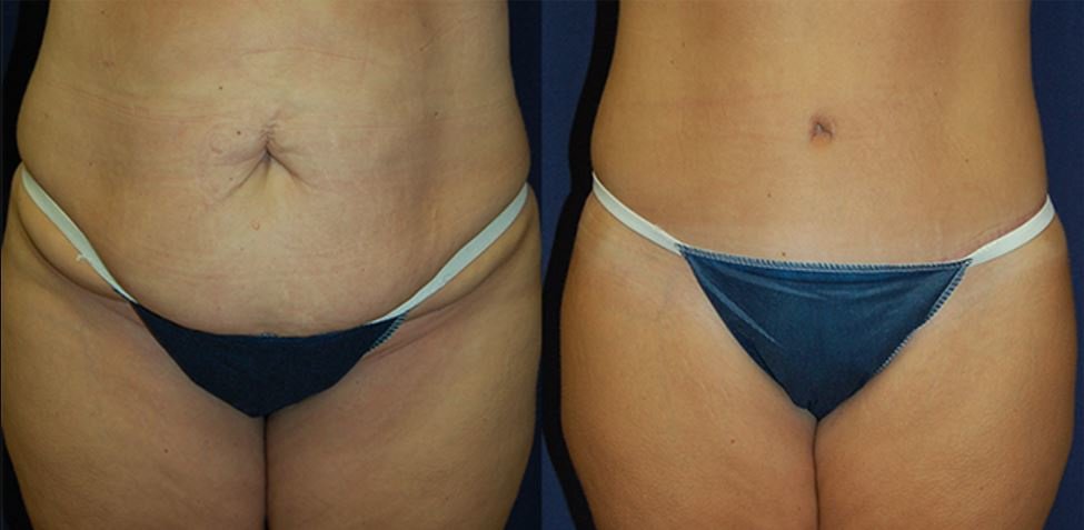 Clínica Láser Puebla - Clínica Láser Puebla