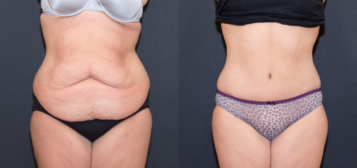 Clínica Láser Puebla - Clínica Láser Puebla