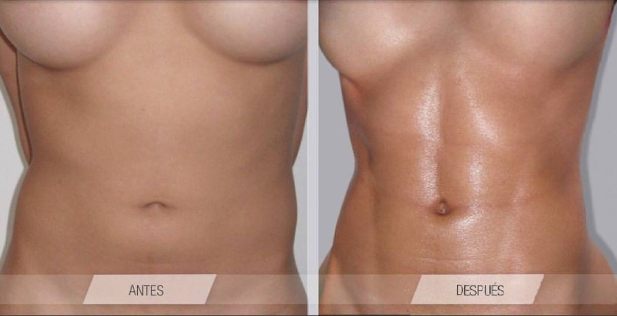 Clínica Láser Puebla - Clínica Láser Puebla