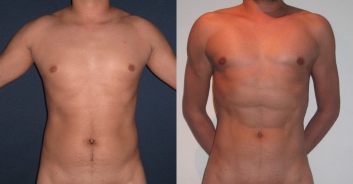 Clínica Láser Puebla - Clínica Láser Puebla