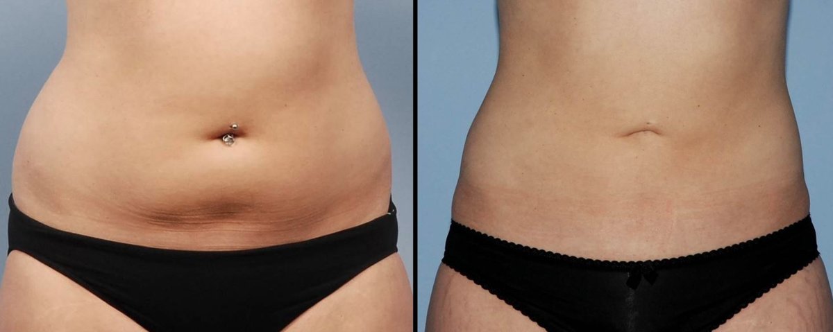 Clínica Láser Puebla - Clínica Láser Puebla