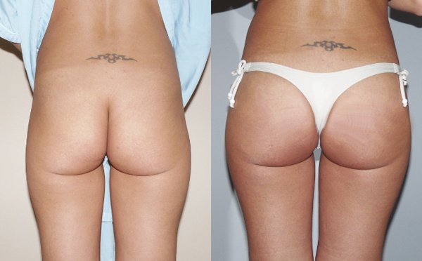 Clínica Láser Puebla - Clínica Láser Puebla