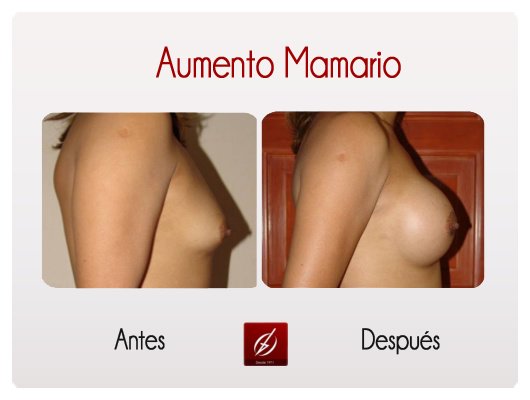 Clínica Láser Puebla - Clínica Láser Puebla