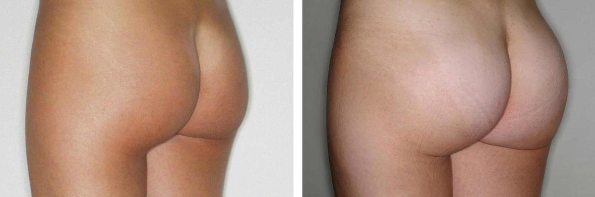 Clínica Láser Puebla - Clínica Láser Puebla