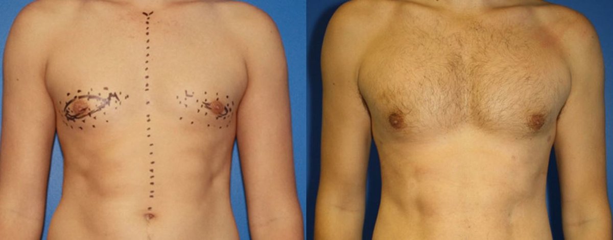 Clínica Láser Puebla - Clínica Láser Puebla