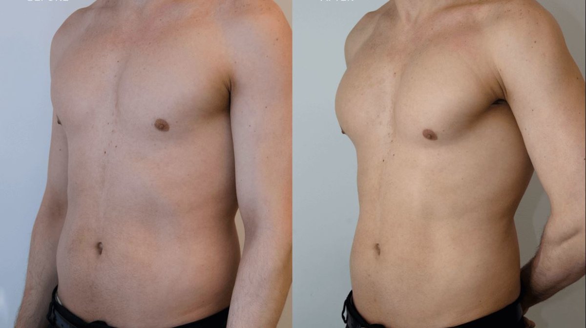 Clínica Láser Puebla - Clínica Láser Puebla