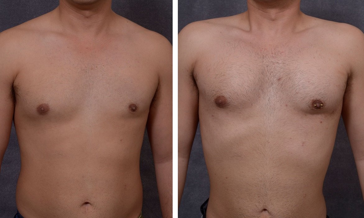 Clínica Láser Puebla - Clínica Láser Puebla