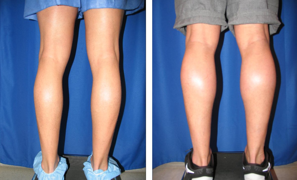 Clínica Láser Puebla - Clínica Láser Puebla