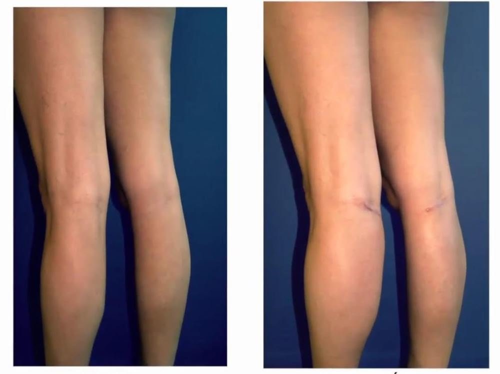 Clínica Láser Puebla - Clínica Láser Puebla