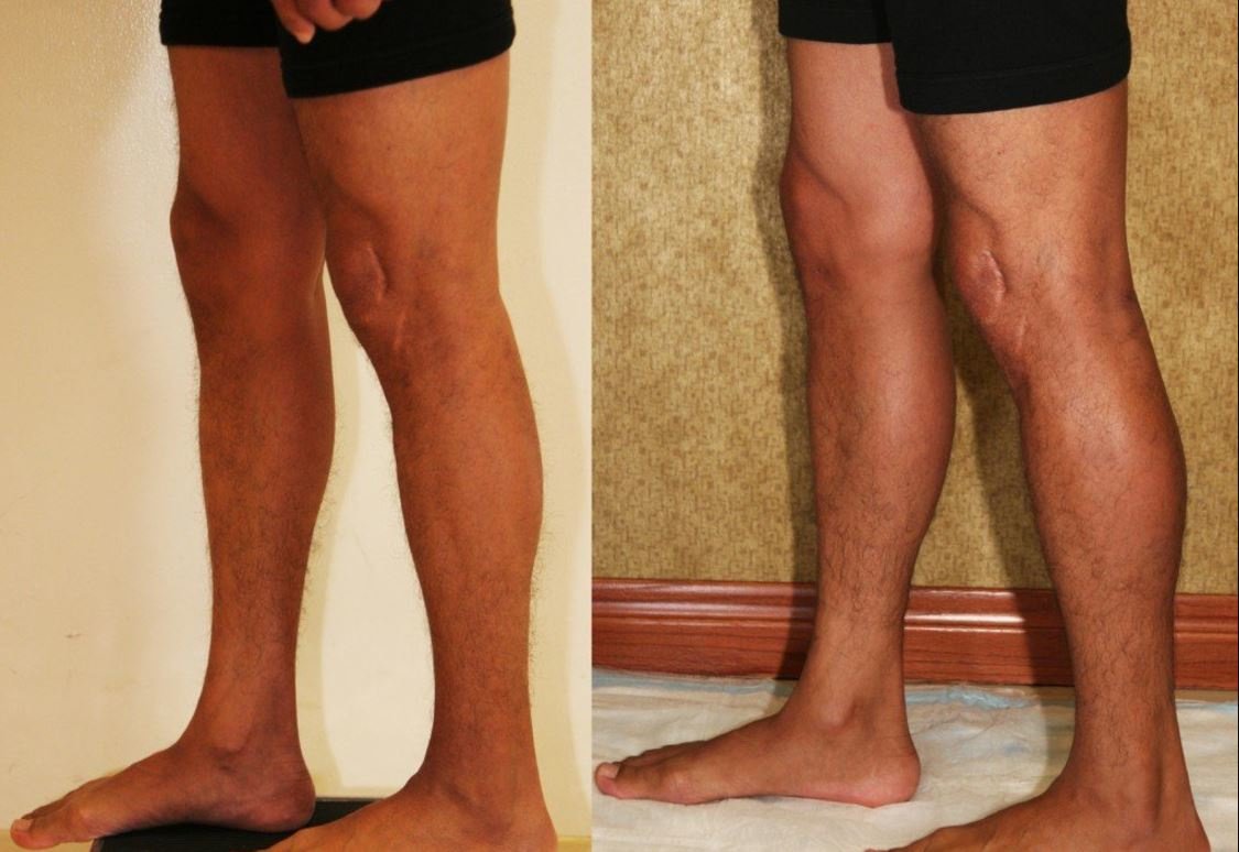 Clínica Láser Puebla - Clínica Láser Puebla