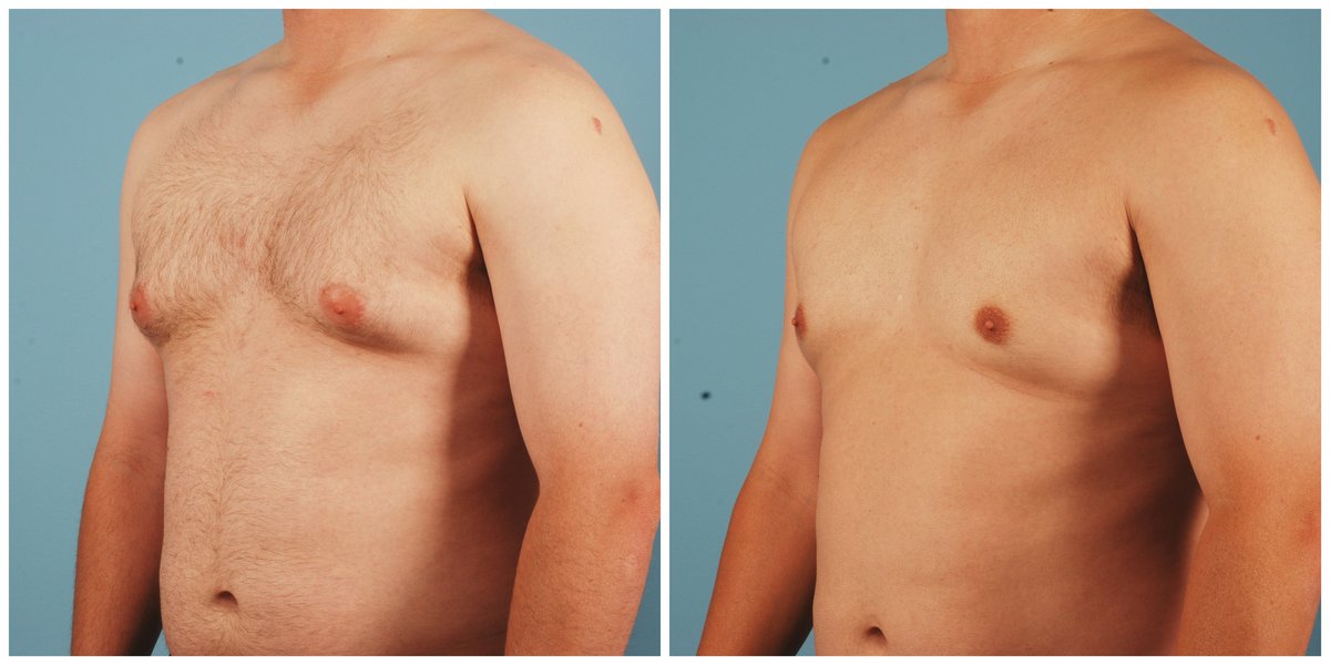 Clínica Láser Puebla - Clínica Láser Puebla