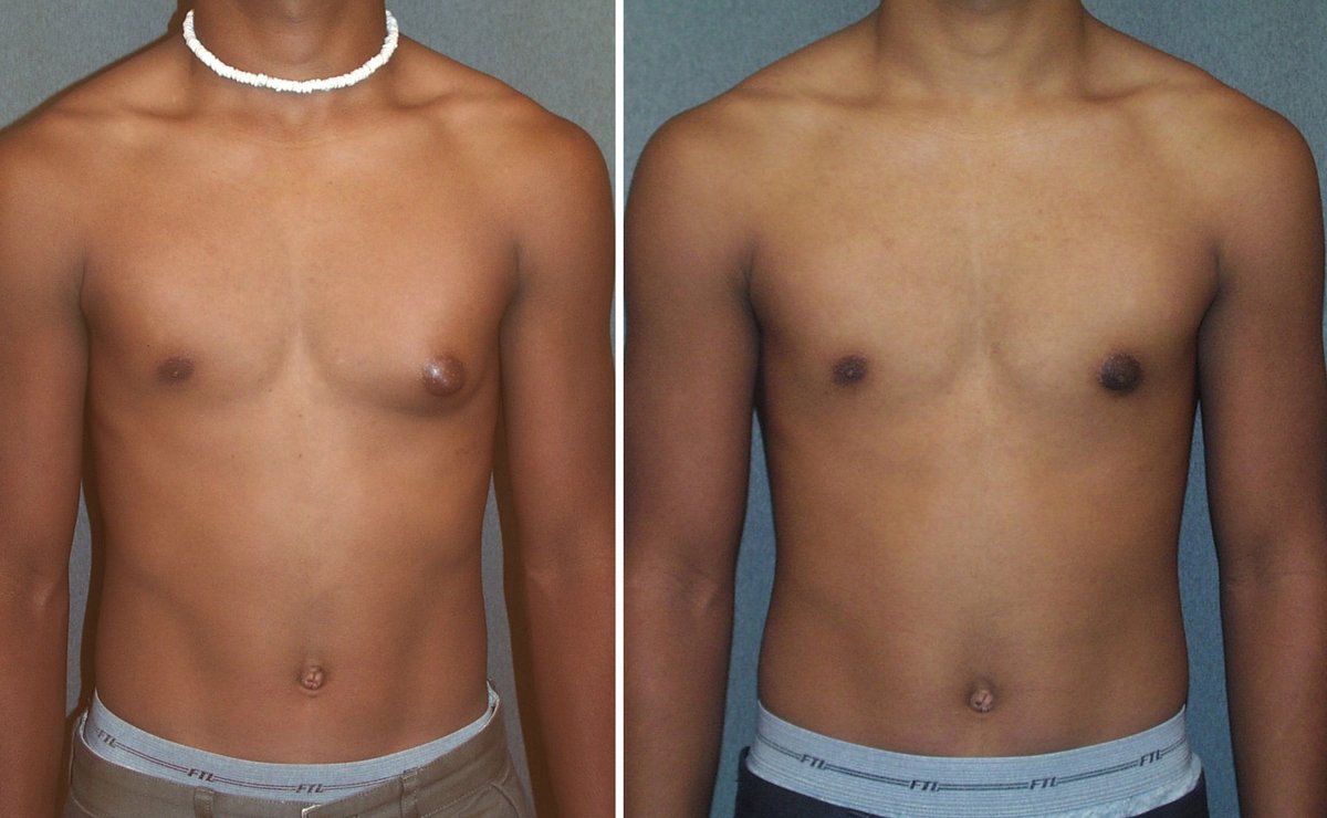 Clínica Láser Puebla - Clínica Láser Puebla