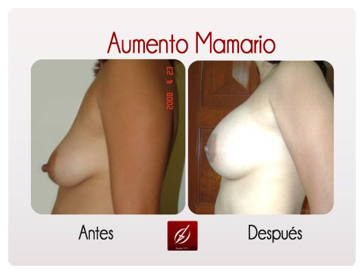 Clínica Láser Puebla - Clínica Láser Puebla