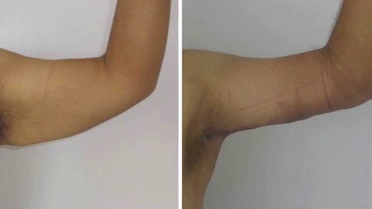 Clínica Láser Puebla - Clínica Láser Puebla