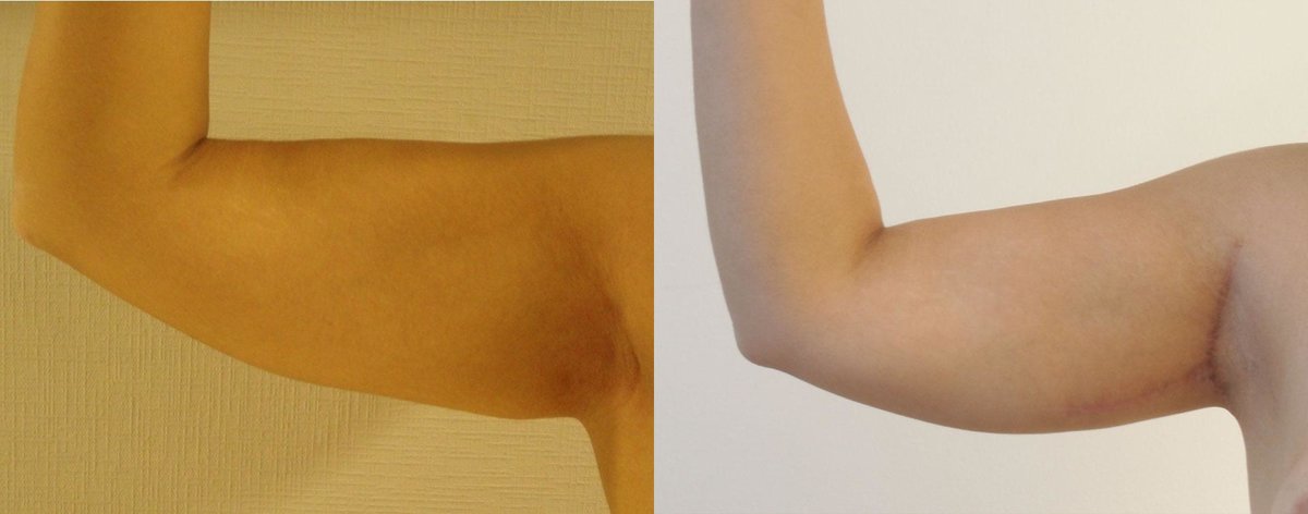 Clínica Láser Puebla - Clínica Láser Puebla