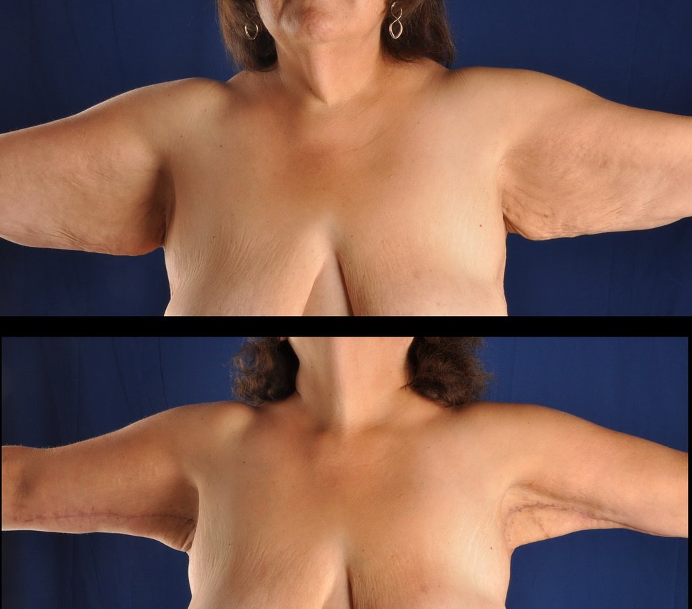 Clínica Láser Puebla - Clínica Láser Puebla