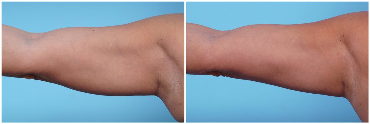 Clínica Láser Puebla - Clínica Láser Puebla