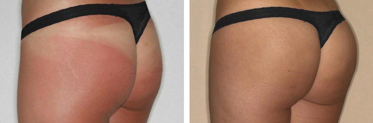 Clínica Láser Puebla - Clínica Láser Puebla