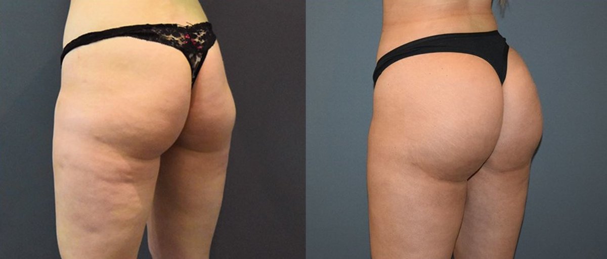 Clínica Láser Puebla - Clínica Láser Puebla