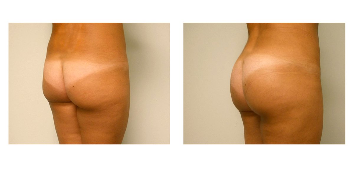 Clínica Láser Puebla - Clínica Láser Puebla