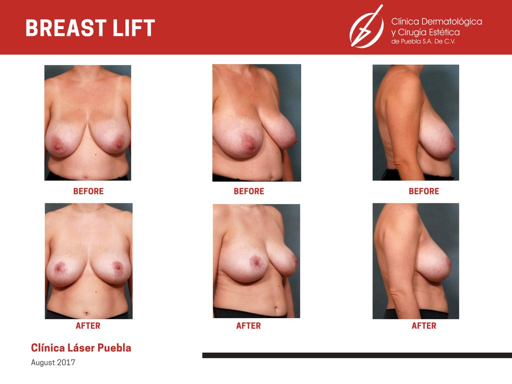 Clínica Láser Puebla - Clínica Láser Puebla