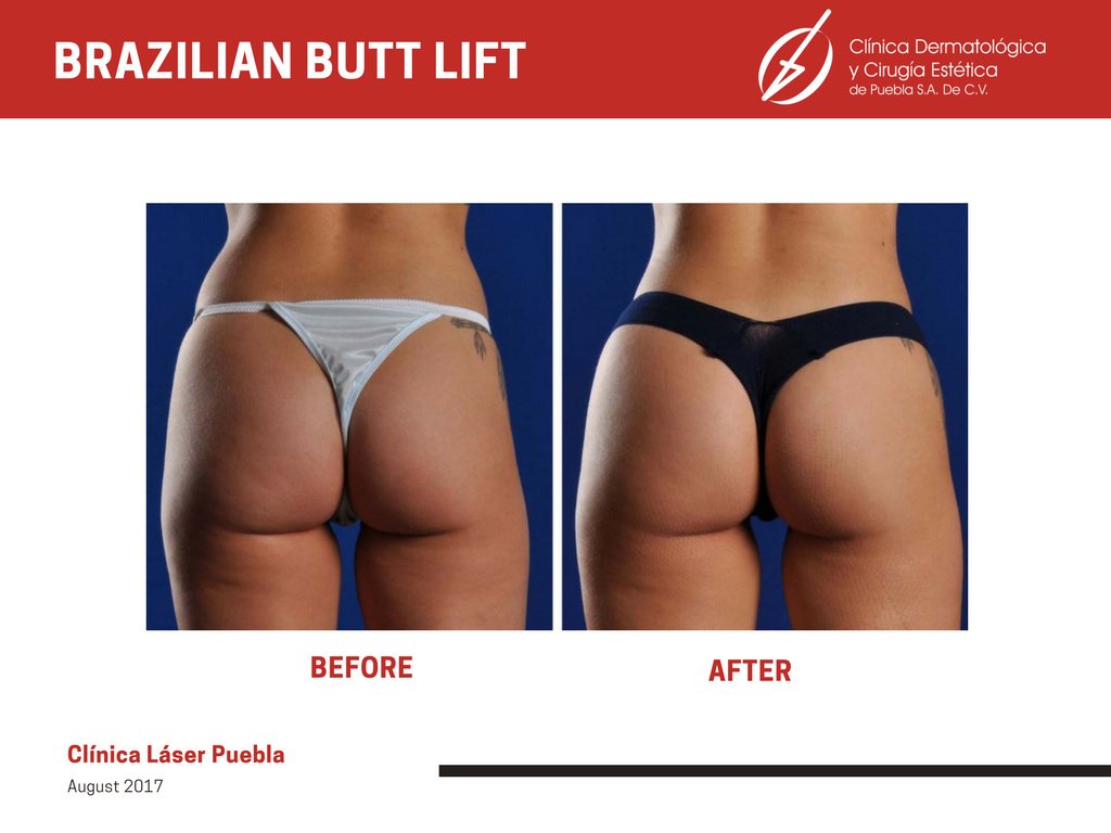 Clínica Láser Puebla - Clínica Láser Puebla