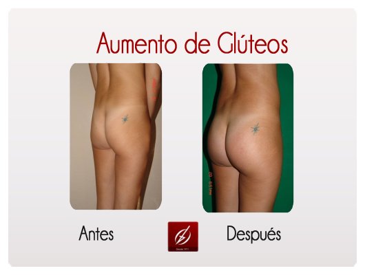 Clínica Láser Puebla - Clínica Láser Puebla