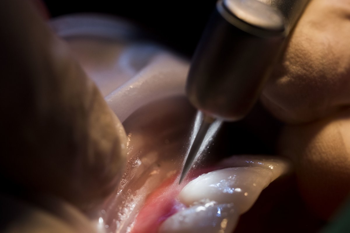 Clínica Odonotología Avanzada - Clínica Odonotología Avanzada