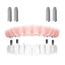 Clinica odontoiatrica Roma - Clinica odontoiatrica Roma