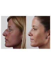 Clínica Rinos Tarragona - Clínica Rinos Tarragona