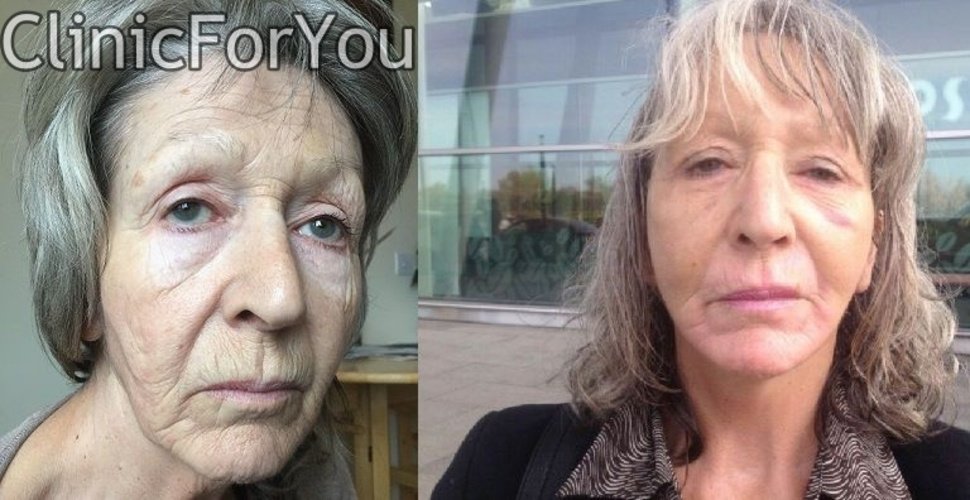 ClinicForYou - ClinicForYou