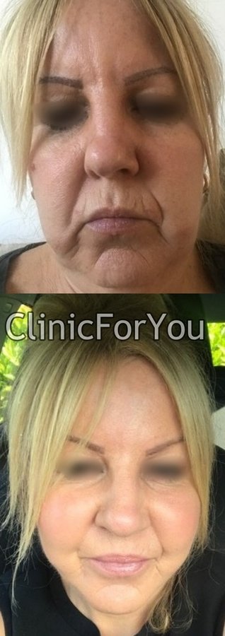 ClinicForYou - ClinicForYou
