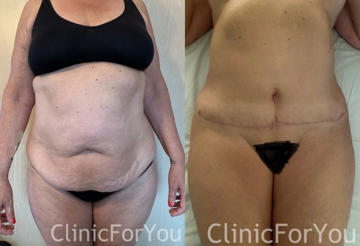 ClinicForYou - ClinicForYou