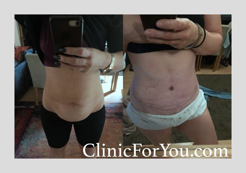 ClinicForYou - ClinicForYou