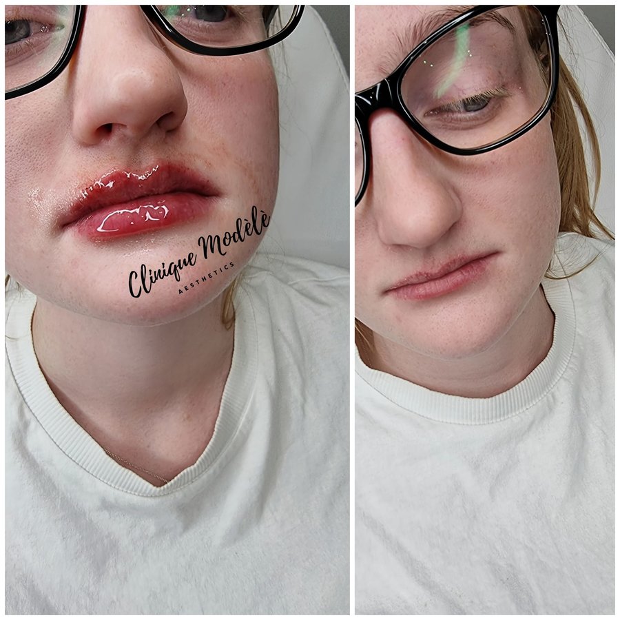 Clinique Modèlè Aesthetics - Clinique Modèlè Aesthetics