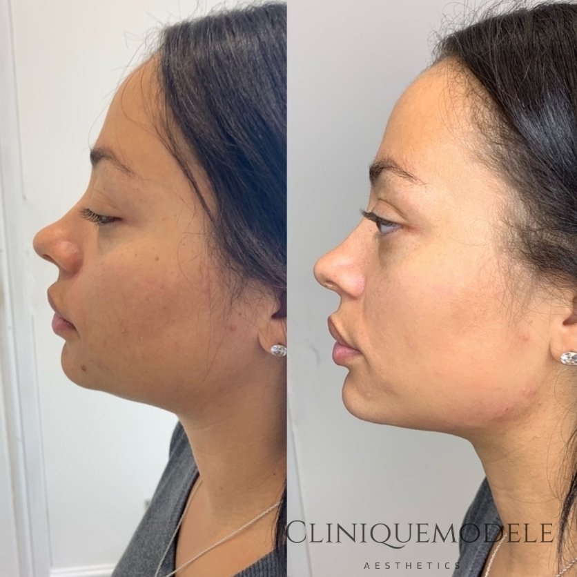 Clinique Modèlè Aesthetics - Clinique Modèlè Aesthetics