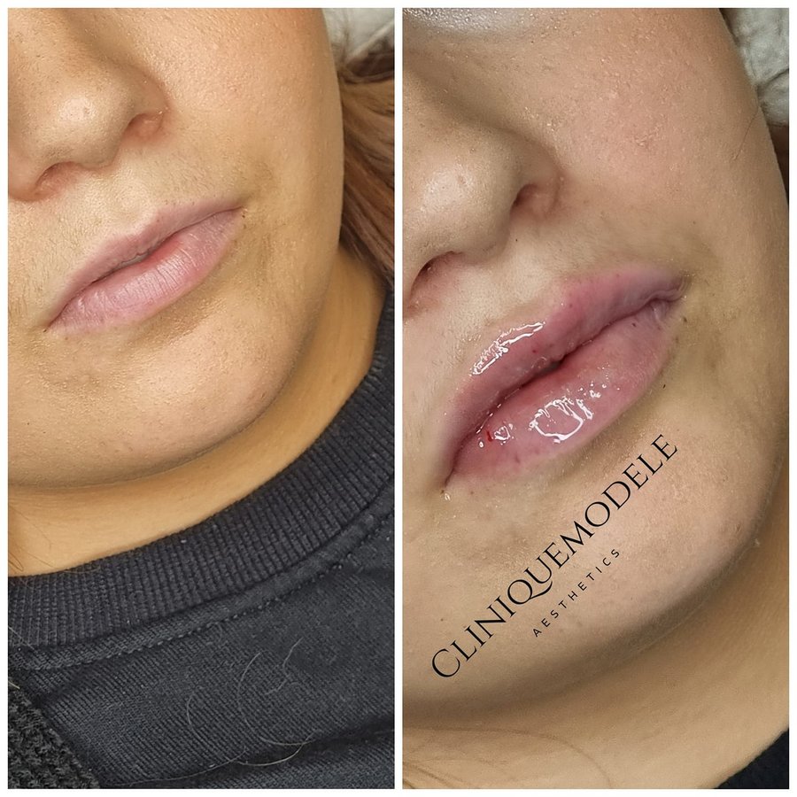 Clinique Modèlè Aesthetics - Clinique Modèlè Aesthetics