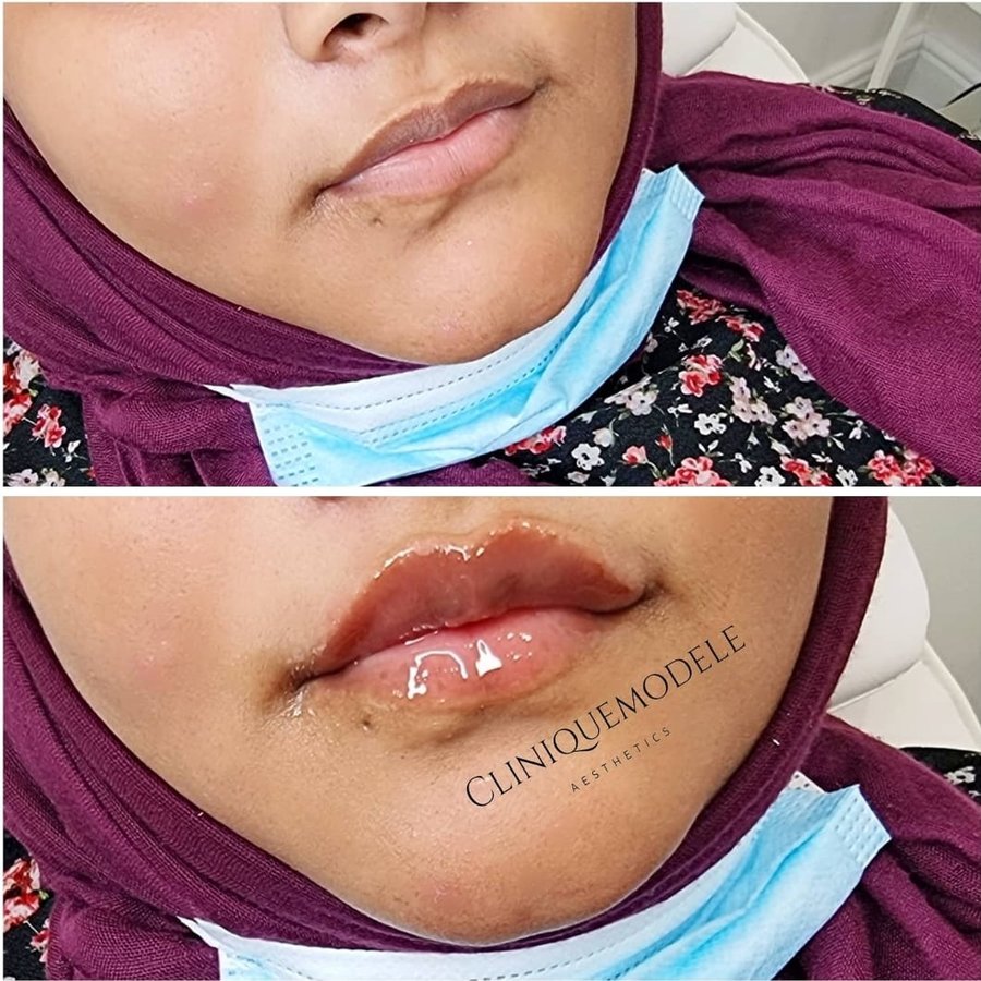 Clinique Modèlè Aesthetics - Clinique Modèlè Aesthetics