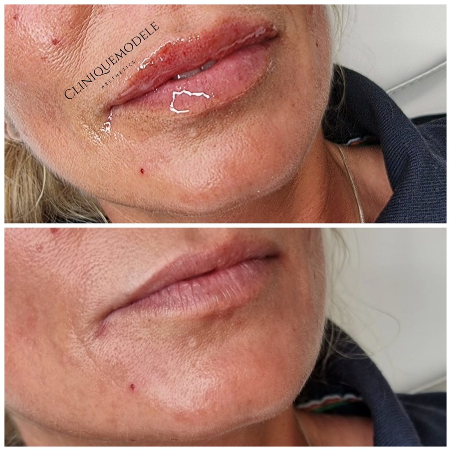 Clinique Modèlè Aesthetics - Clinique Modèlè Aesthetics