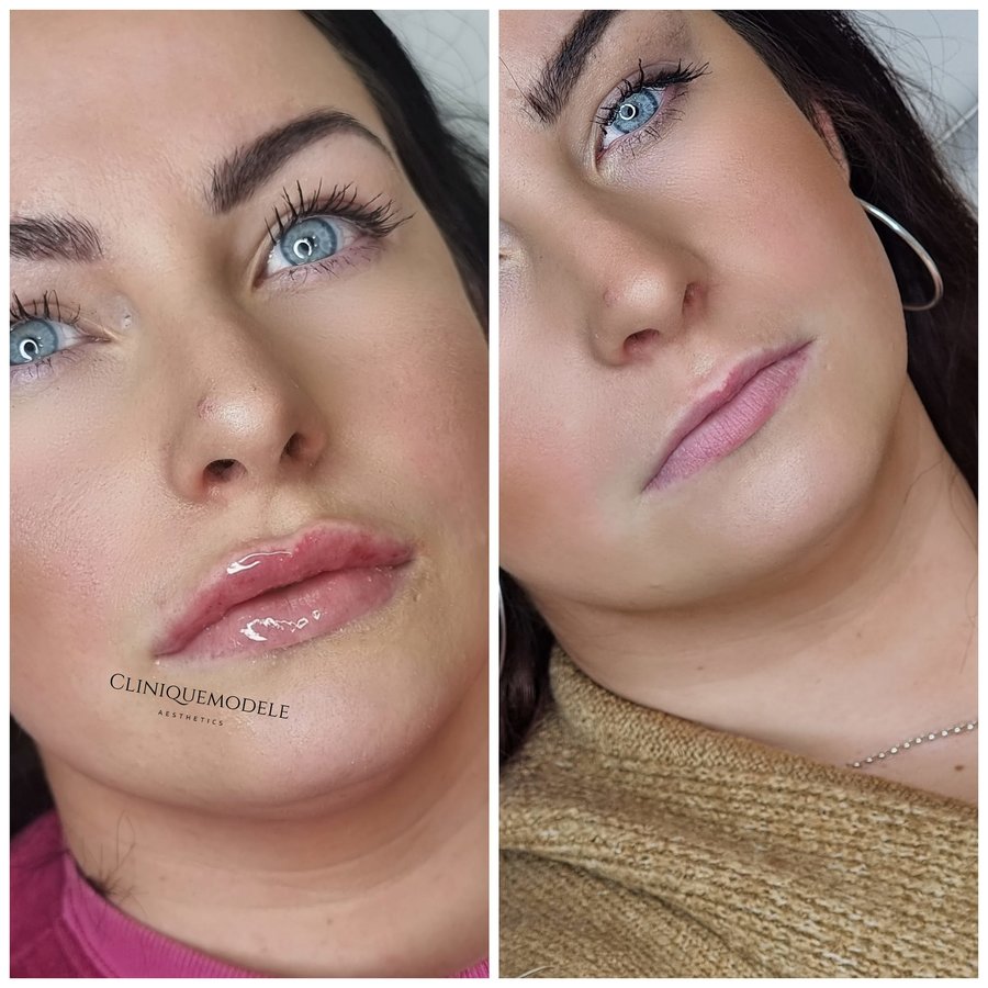 Clinique Modèlè Aesthetics - Clinique Modèlè Aesthetics