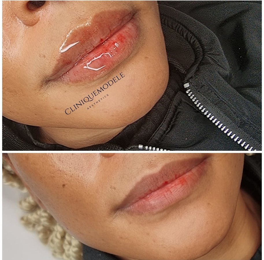 Clinique Modèlè Aesthetics - Clinique Modèlè Aesthetics