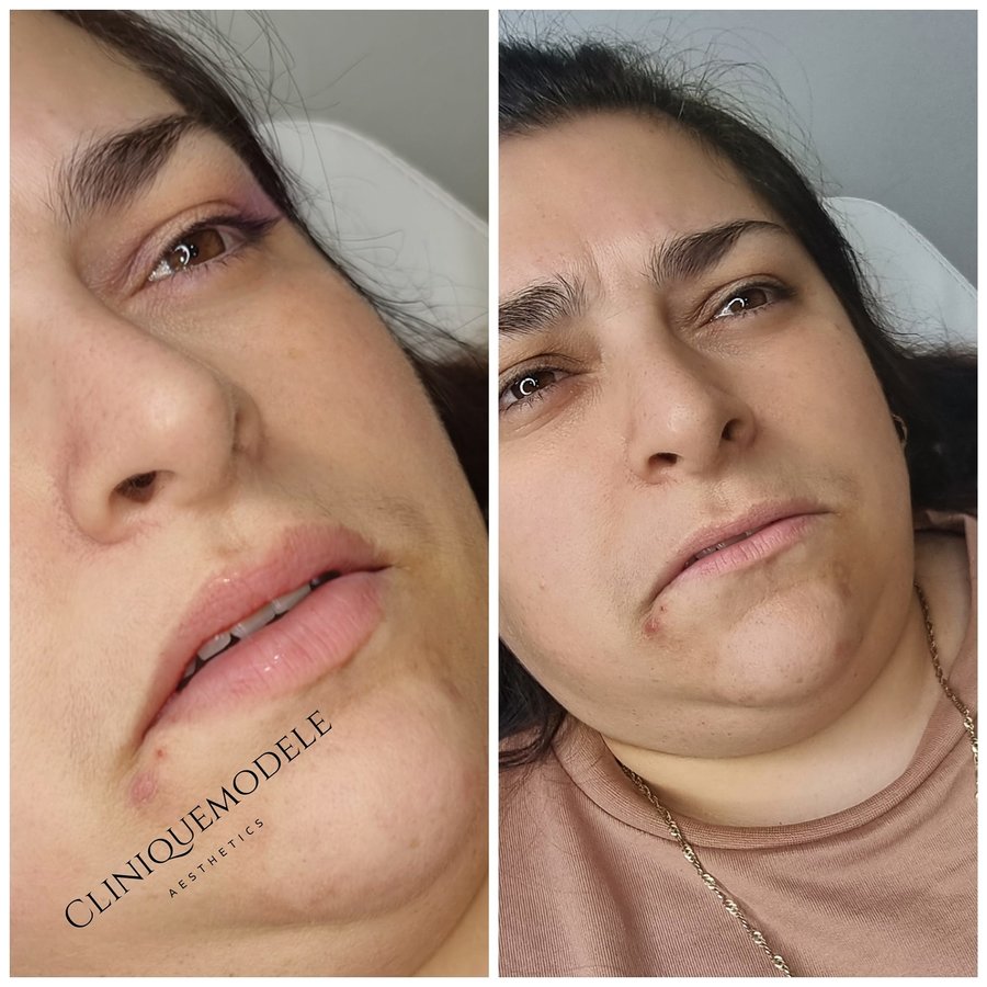 Clinique Modèlè Aesthetics - Clinique Modèlè Aesthetics