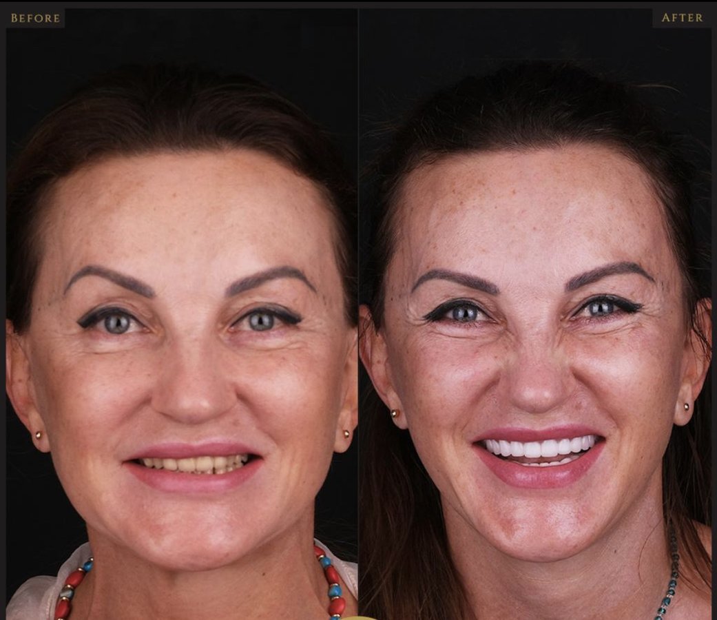 Clinish Dental - Clinish Dental