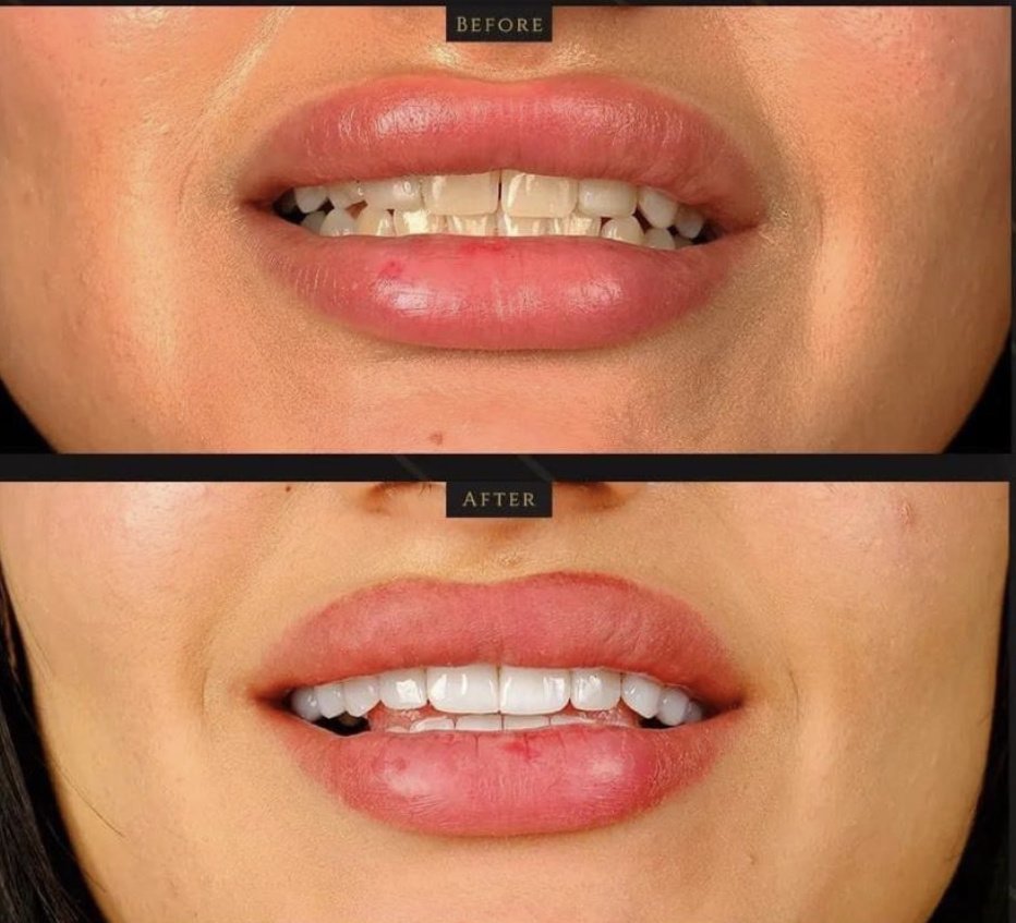 Clinish Dental - Clinish Dental