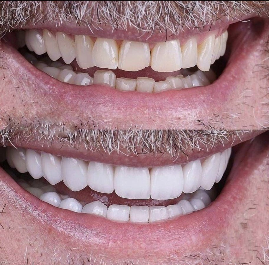 Clinish Dental - Clinish Dental