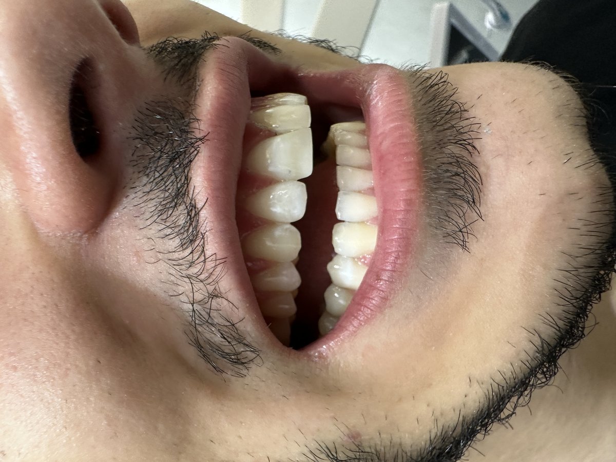 Clinish Dental - Clinish Dental